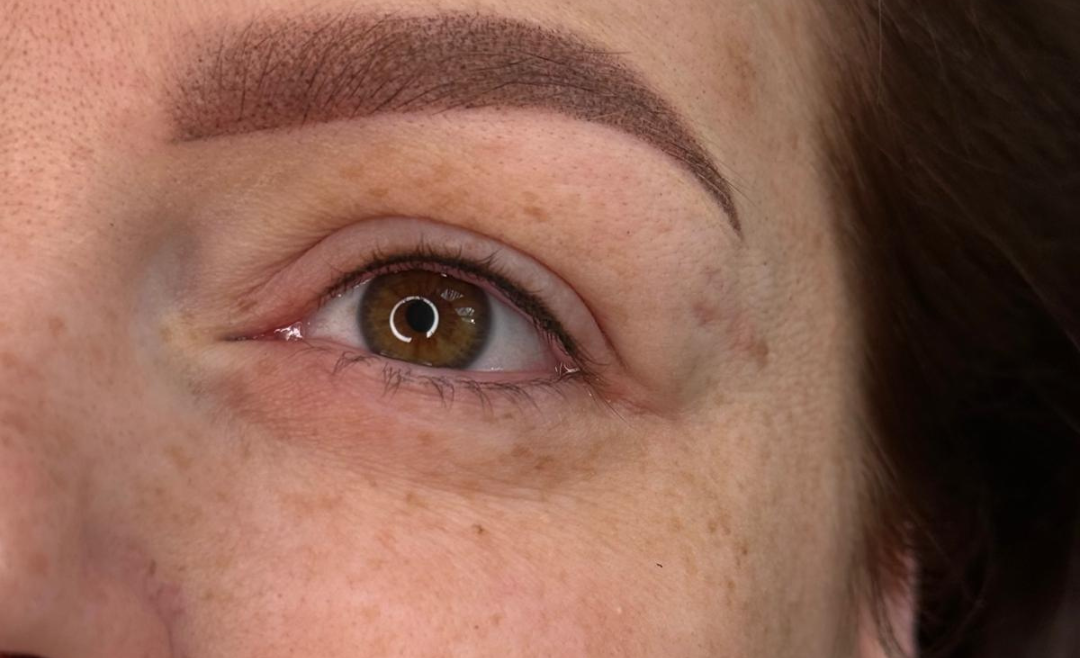 Wimpernkranzverdichtung in Salzburg